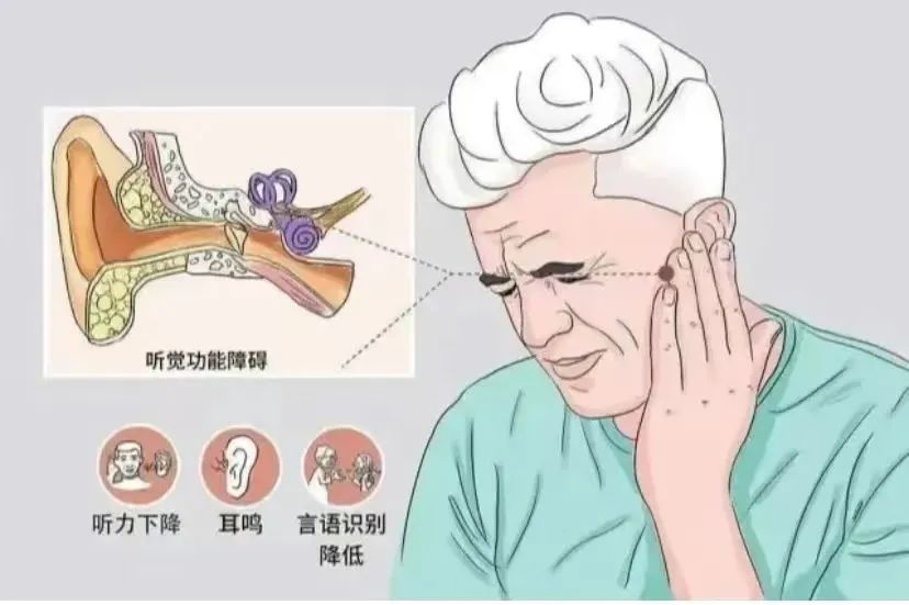 干細胞治療神經性耳聾患者，有效治療聽力甚至耳聾！